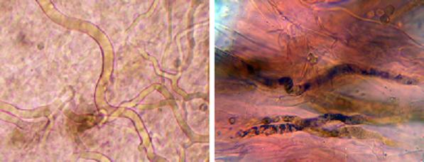 Foto microscopio de hifas laticíferas Foto microscopio de hifas oleíferas